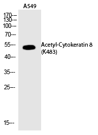 Rabbit Polyclonal Antibody to Cytokeratin 8 (Acetyl-Lys483)