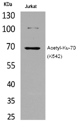 Rabbit Polyclonal Antibody to Ku-7(Acetyl-Lys542)