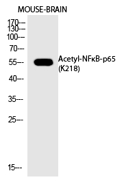 Rabbit Polyclonal Antibody to NFκB-p65 (Acetyl-Lys218)