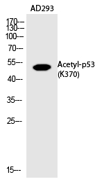Rabbit Polyclonal Antibody to p53 (Acetyl-Lys370)