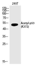 Rabbit Polyclonal Antibody to p53 (Acetyl-Lys372)