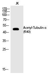 Rabbit Polyclonal Antibody to Tubulin α (Acetyl-Lys40)