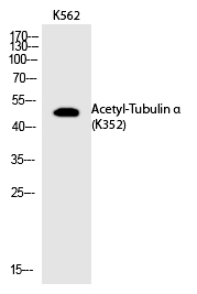 Rabbit Polyclonal Antibody to Tubulin α (Acetyl-Lys352)