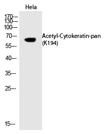 Rabbit Polyclonal Antibody to Cytokeratin-pan (Acetyl-Lys194)