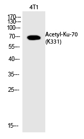 Rabbit Polyclonal Antibody to Ku-7(Acetyl-Lys331)