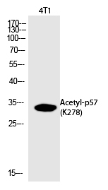 Rabbit Polyclonal Antibody to p57 (Acetyl-Lys278)