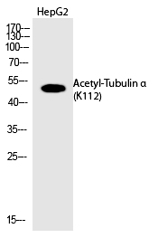 Rabbit Polyclonal Antibody to Tubulin α (Acetyl-Lys112)
