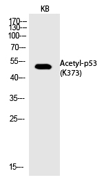 Rabbit Polyclonal Antibody to p53 (Acetyl-Lys373)