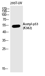 Rabbit Polyclonal Antibody to p53 (Acetyl-Lys382)