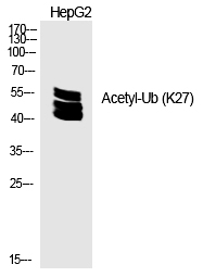 Rabbit Polyclonal Antibody to Ub (Acetyl-Lys27)