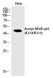 Rabbit Polyclonal Antibody to NFκB-p65 (Acetyl-Lys314/Lys315)