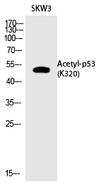 Rabbit Polyclonal Antibody to p53 (Acetyl-Lys320)