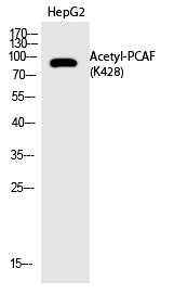 Rabbit Polyclonal Antibody to PCAF (Acetyl-Lys428)