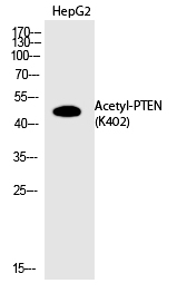 Rabbit Polyclonal Antibody to PTEN (Acetyl-Lys402)