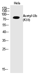 Rabbit Polyclonal Antibody to Ub (Acetyl-Lys33)
