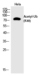 Rabbit Polyclonal Antibody to Ub (Acetyl-Lys48)