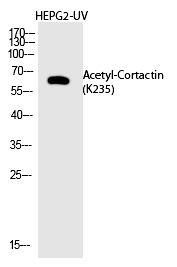Rabbit Polyclonal Antibody to Cortactin (Acetyl-Lys235)