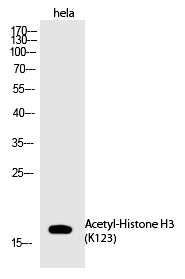 Rabbit Polyclonal Antibody to Histone H3 (Acetyl-Lys123)