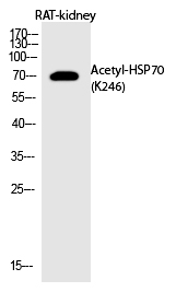 Rabbit Polyclonal Antibody to HSP7(Acetyl-Lys246)