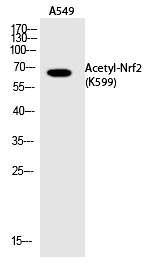 Rabbit Polyclonal Antibody to Nrf2 (Acetyl-Lys599)