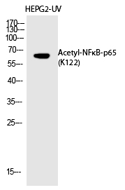 Rabbit Polyclonal Antibody to NFκB-p65 (Acetyl-Lys122)