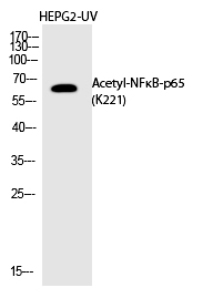 Rabbit Polyclonal Antibody to NFκB-p65 (Acetyl-Lys221)