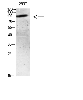 Rabbit Polyclonal Antibody to AR (Acetyl Lys633)