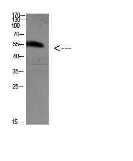 Rabbit Polyclonal Antibody to FoxO4 (Acetyl Lys189)
