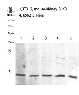 Rabbit Polyclonal Antibody to Histone H2B (Acetyl Lys21)