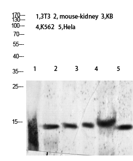 Rabbit Polyclonal Antibody to Histone H2B (Acetyl-Lys24/25)