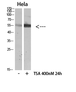 Rabbit Polyclonal Antibody to HNF-4α (Acetyl Lys106)