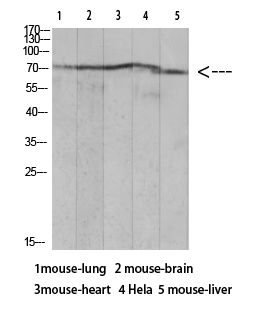 Rabbit Polyclonal Antibody to Ku-7(Acetyl Lys317)