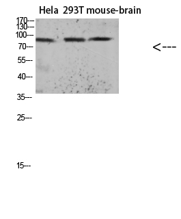 Rabbit Polyclonal Antibody to Tau (Acetyl Lys174)