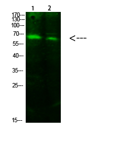 Rabbit Polyclonal Antibody to ACSS1 (Acetyl-K642)