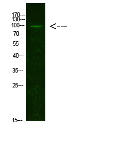 Rabbit Polyclonal Antibody to AR(Acetyl-K631)