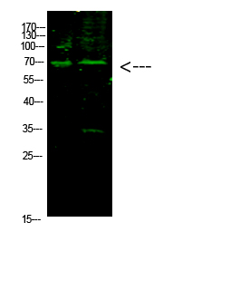 Rabbit Polyclonal Antibody to E2F-1 (Acetyl-K117)