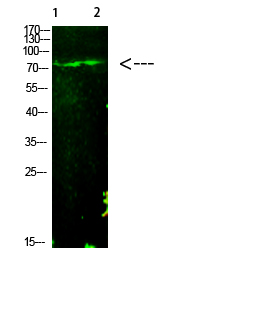 Rabbit Polyclonal Antibody to E2F-1 (Acetyl-K125)