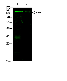 Rabbit Polyclonal Antibody to Rb (Acetyl-K873/K874)
