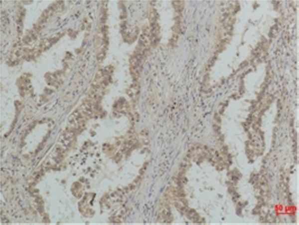 Mouse Monoclonal Antibody to P53(Mono Methyl Lys370)(Q59)