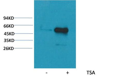 Mouse Monoclonal Antibody to α-tubulin (Acetyl Lys40)(4A8)(4A8)