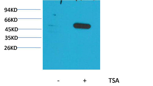 Mouse Monoclonal Antibody to α-tubulin (Acetyl Lys40)(5H5)
