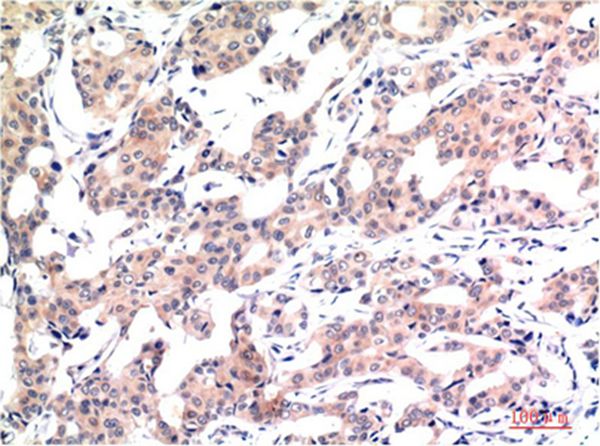 Mouse Monoclonal Antibody to Acetyl-Histone H3 (K9)(2E7)