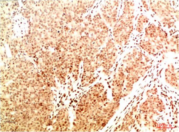 Mouse Monoclonal Antibody to Acetyl NF kB P65(K314/K315) (2A11)