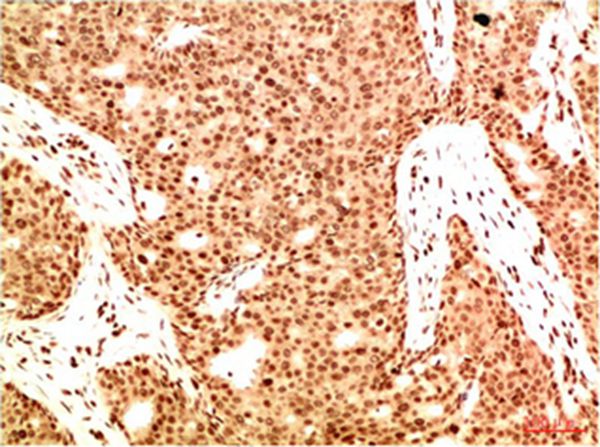 Mouse Monoclonal Antibody to Acetyl NF kB P65 (K314/K315) (5G11)