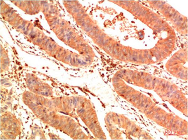 Mouse Monoclonal Antibody to Acetyl P53(K382) (1G7)