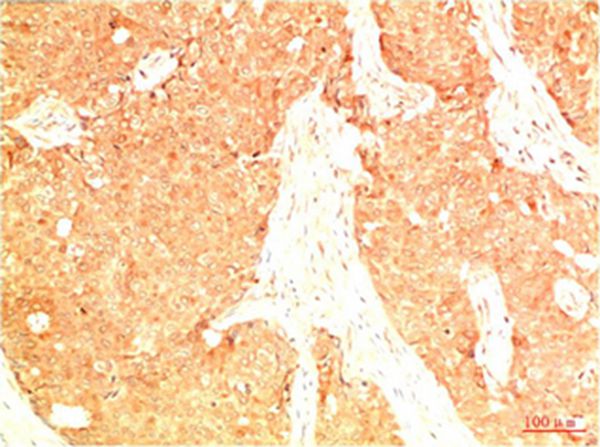 Mouse Monoclonal Antibody to Acetyl P53(K382) (15F4)