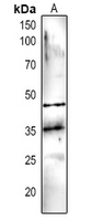 Rabbit Polyclonal Antibody to DEGP5
