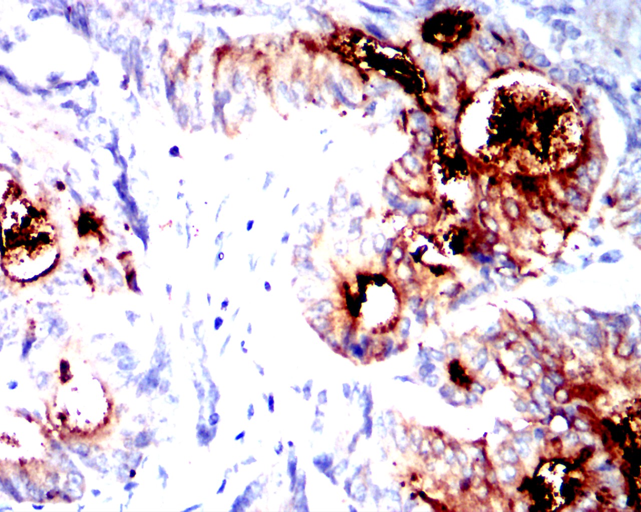 Mouse Monoclonal Antibody to CEACAM5